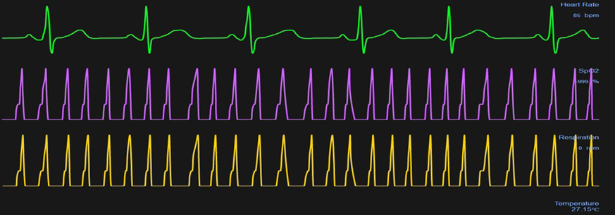 figure 18